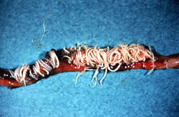Helminths tapeworm, Helminths parasitic worms